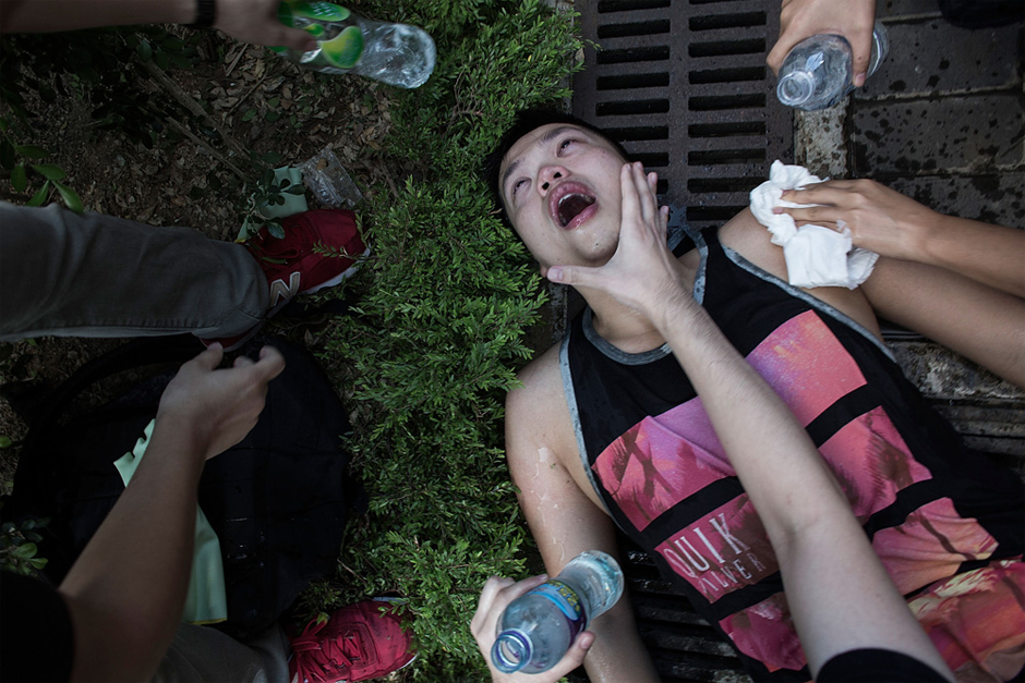 An injured protester is tended to after clashing with riot police. (Photo by Lam Yik Fei/Getty Images)